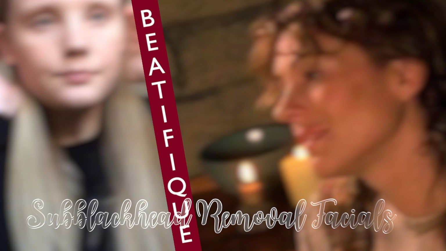 Blackhead Removal Facials_4C7C539F 1210 3Ea6 9Ad4 Be58Da15127D.jpeg