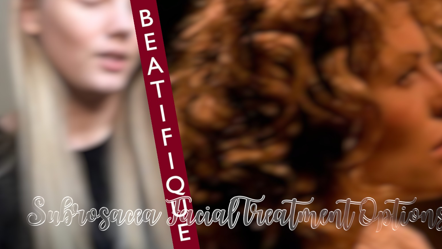 Rosacea Facial Treatment Options_4Cff2Feb 9C34 4Fd0 4C95 1Fff268A7184.Jpeg